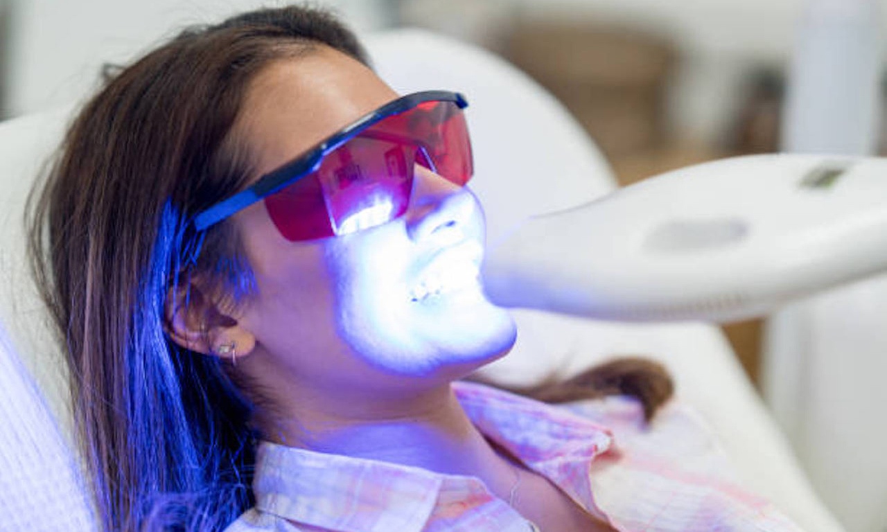 Brighten Your Smile with 45 or 60 Min Teeth Whitening