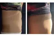One or Two 90-Minute Full Body Sculpt & Detox Treatments with Ultrasonic Fat Cavitation ( Up to 46% Off ) - Second Medium