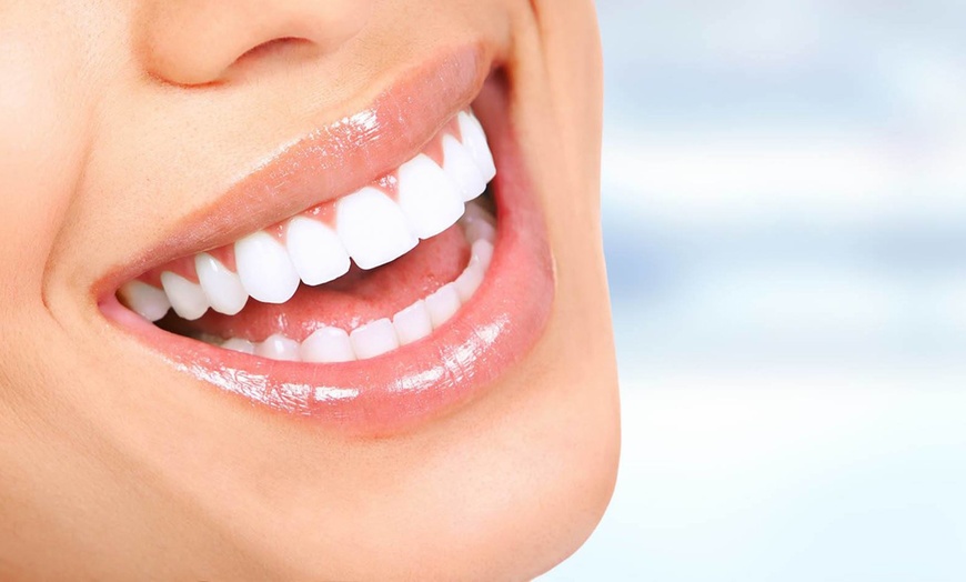 Image 1: Teeth Whitening Treatment