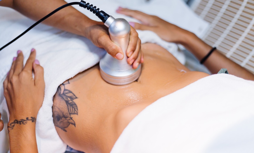 Image 2:  Blast Away Fat: Experience the Magic of Ultrasonic Reduction!