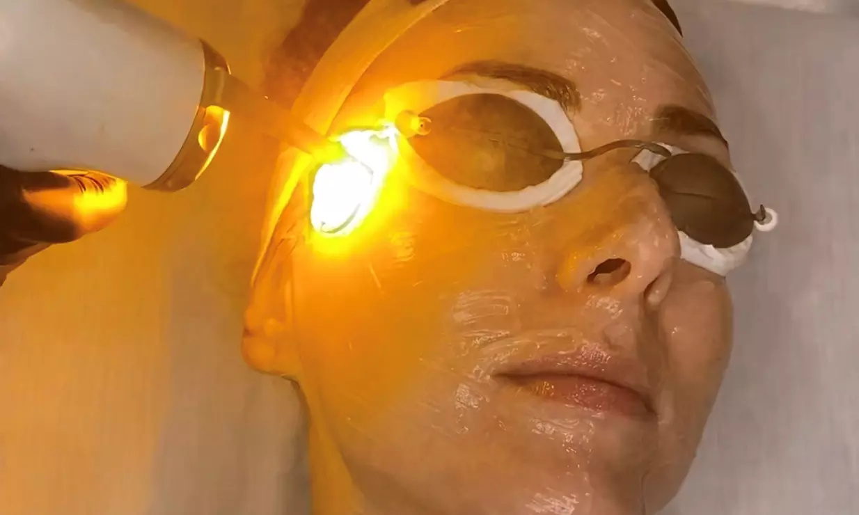 Experience Loma Laser's rejuvenating facial treatments with options for everyone, offering up to 64% off! - Primary Image