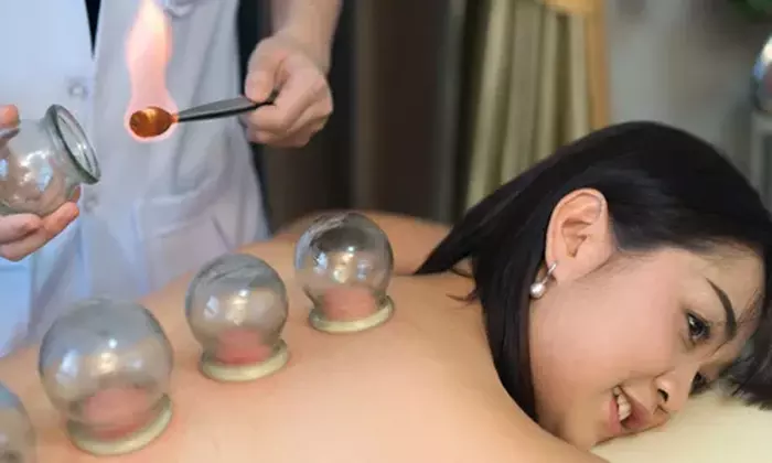 Relieve Aches with  One or Two Acupuncture Sessions with Optional Cuppings @Purple Tree Herbs (Up to 48%
Off) - Primary Image