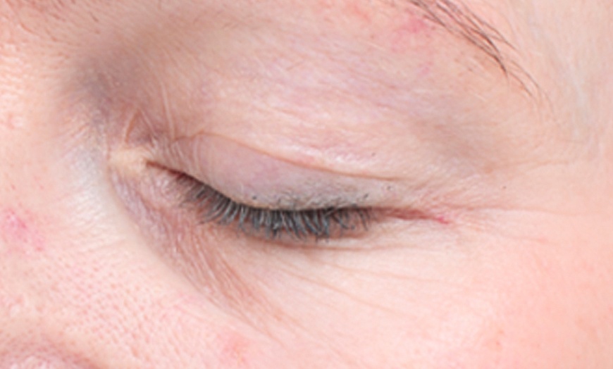 Image 5: CACI Facial Treatment