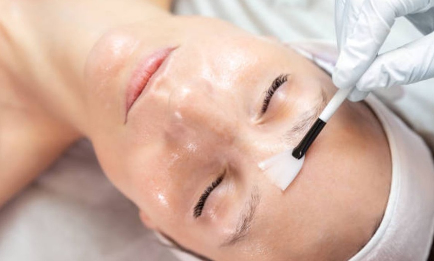 Image 4: 1 o 2 sesiones de limpieza facial con tratamiento a elegir para 1