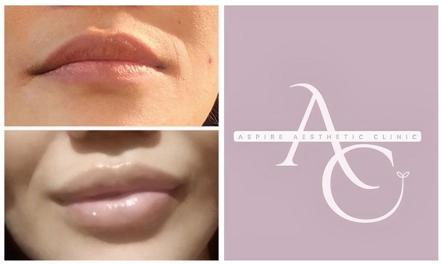 Image 1: Enhance your Lips with Expert Dermal Filler Treatments in Wembley!