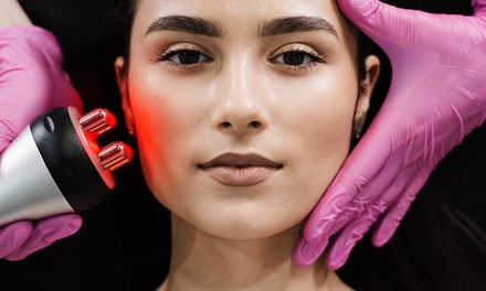 One Micro-Needling Session with Photobiomodulation Therapy - Image District Face And Body