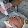 Image 1: Up to 50% Off on HydraFacial at Rosenfeld Esthetics