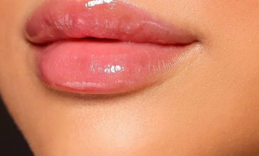 Image 7: Smooth, plump, and refreshed – now enjoy up to 33% off Filler!