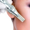 Image 1: Microneedling facial con ácido hialurónico, vitaminas y colágeno