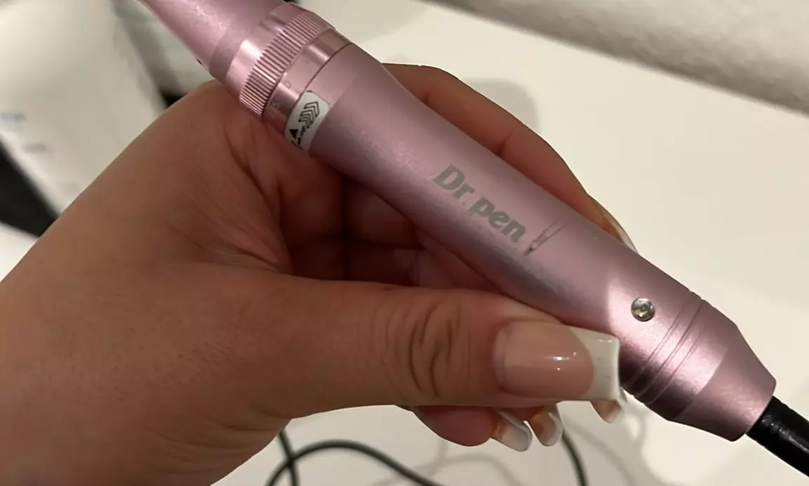 Frische & strahlende Haut mit Microneedling: Revitalisiere deine Haut