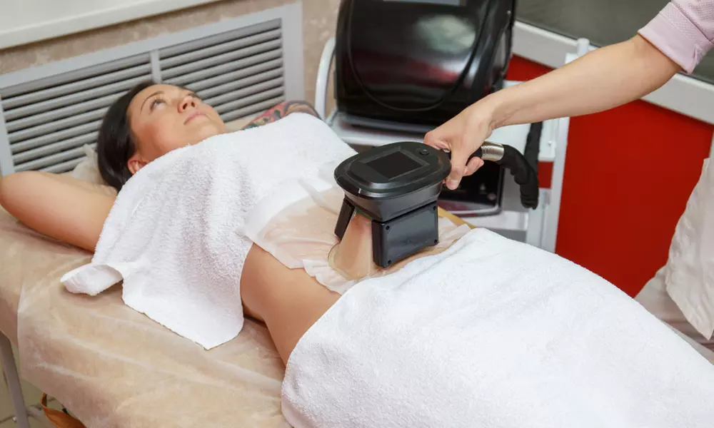 Cryolipolysis Fat Freezing at Miami Kiss