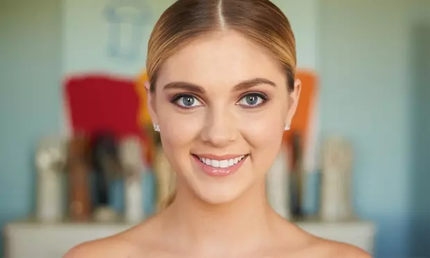Experience complete smile restoration with Elite Smiles Of La Jolla's Dental Implant Procedure offering up to 58% off - Primary Image