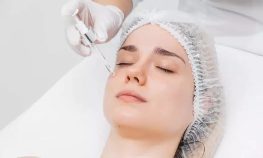 Image 3: Exosomas con dermapen en rostro completo