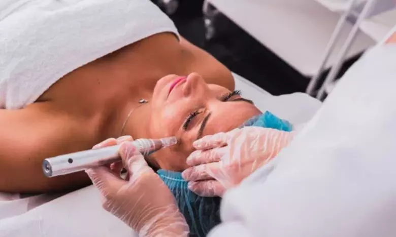 Revitalize Your Look with PRF or PRP Facial Treatments