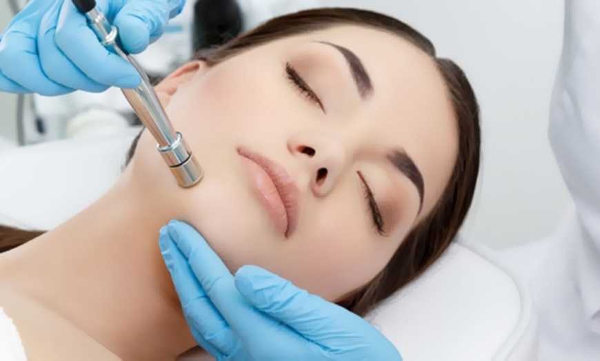 Image 8: ¡Limpieza facial con radiofrecuencia y microdermoabrasión!