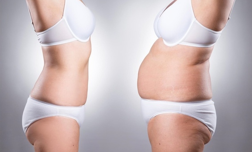 Image 7: Body Contouring with Red Light & Vibration Therapy