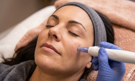 One Micro-Needling Treatment - Tology Beauty Med Spa Lv