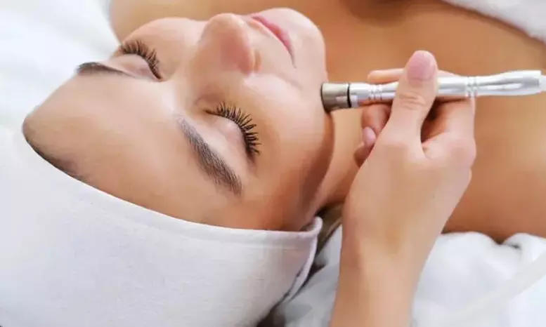 2x 30 Min. Microdermabrasion und/oder Kombi-Angebot 3x od. 5x 30 Min. für 1 od. 2 Personen (bis zu 50% sparen) - Primary Image