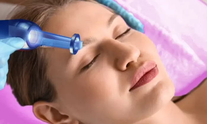Experience Laser Goddess' Picoway Resolve Laser Treatments for Face and Eyes with up to 48% off for a rejuvenated look - Primary Image