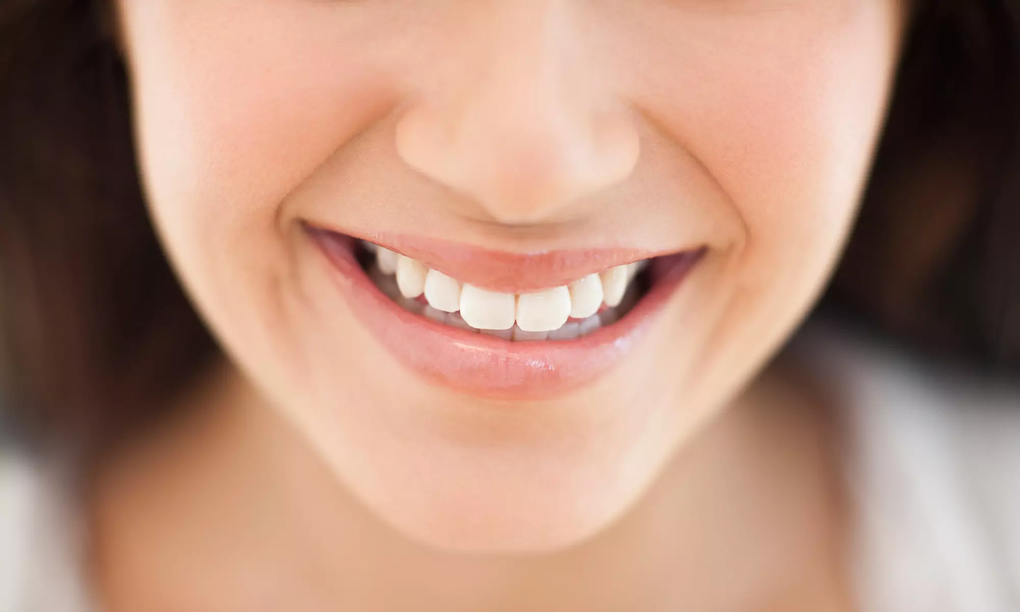 Get a Brighter Smile w/ One / Two 30 or 60 min Teeth Whitening Options