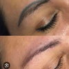 Image 2: Eyebrow Tattoo Removal: Save Up to 30% Off at MB Advanced Beauty MED!
