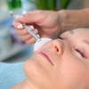 Image 2: Up to 42% Off on Vampire Facelift at Royal Remedy Clinic