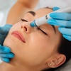 Image 1: Limpieza hydrafacial con opción a diferentes tratamientos