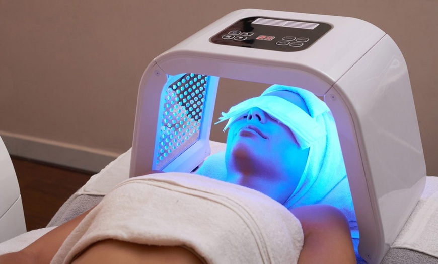 Image 2: Hasta 77% de dto. en Tratamiento facial - Peeling en GLAMUROSA Beauty Salon