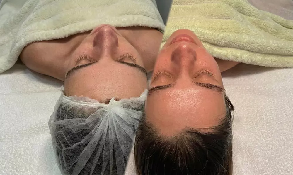 60-Minute Relaxing Facial or Premium Facial with Complimentary Abdominal Line Sugaring (Up to 25% Off) - Image 2