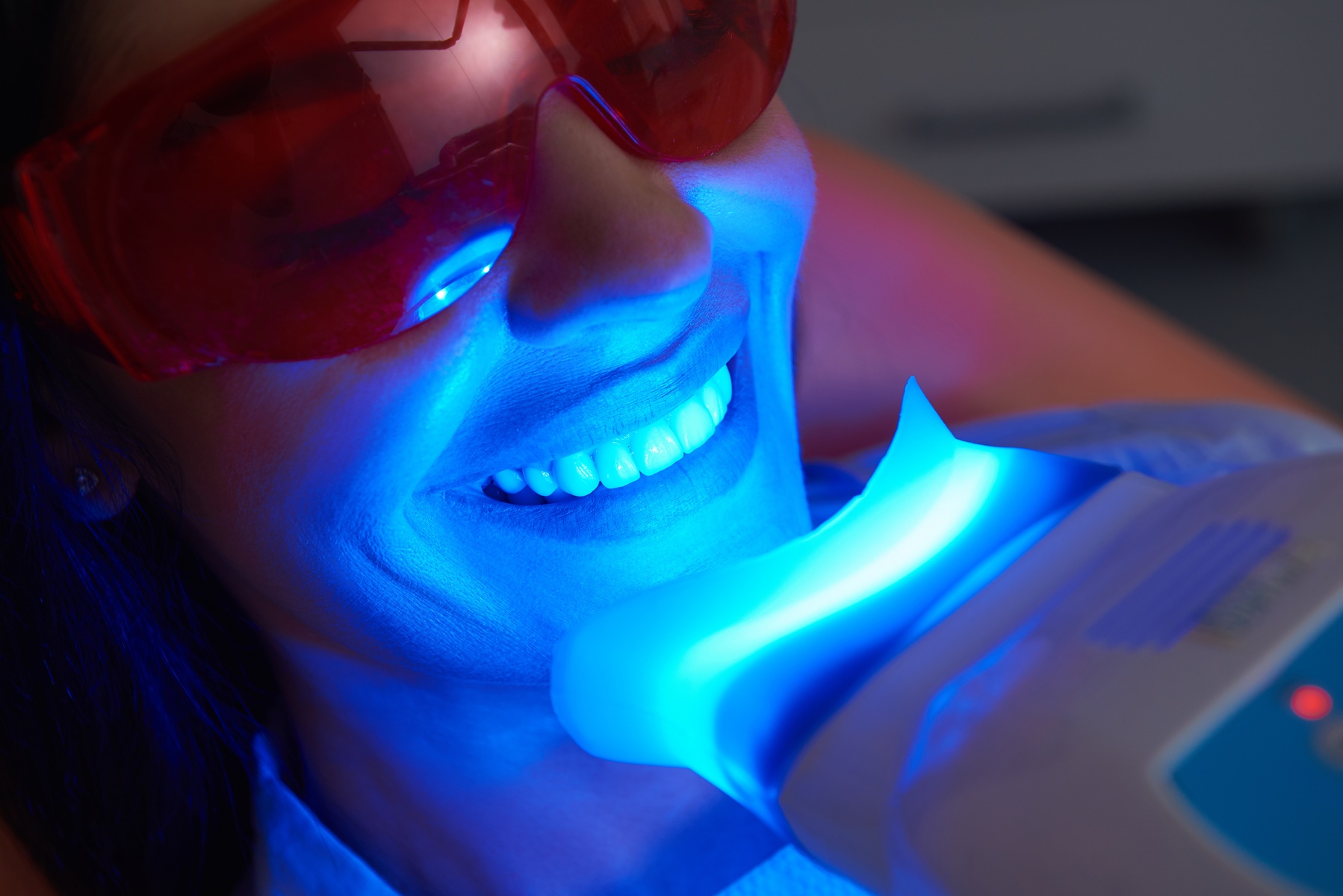 Get a Confident Smile with Teeth Whitening Service