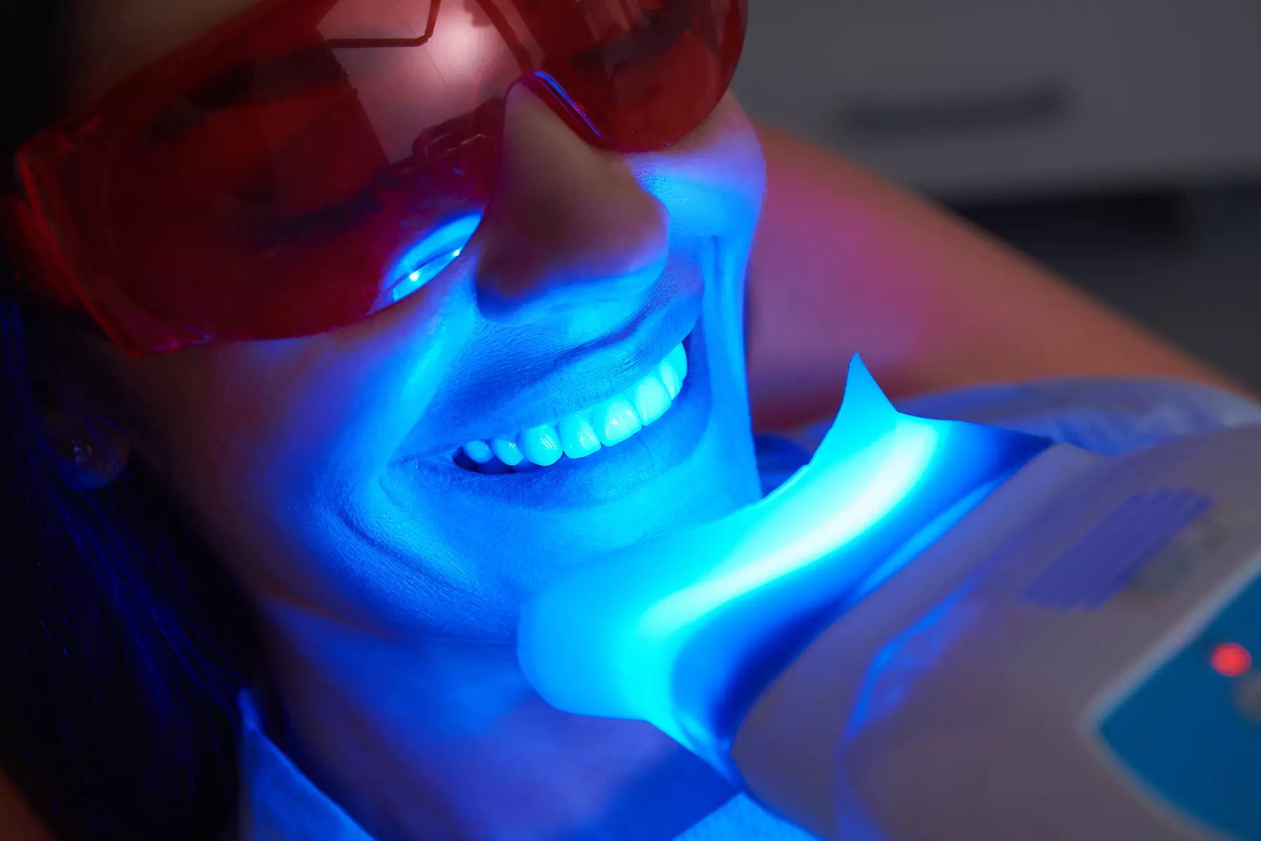 Get a brighter smile with one teeth whitening session