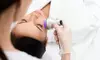 One or Three Radio-Frequency Skin-Tightening Cellulite-Reduction Treatments at Silk MedSpa (Up to 75% Off)