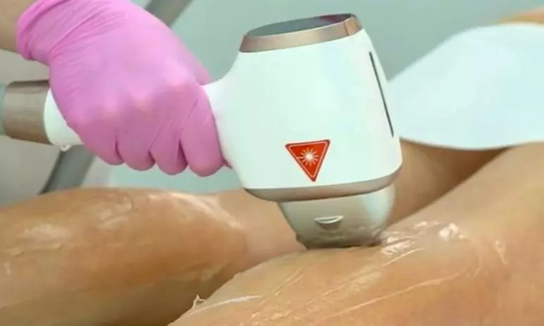 Up to 83% Off on Laser Hair Removal at HL Lasers