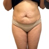 Image 3: Choose from 60 Minute Ultrasonic Cavitation or Skin Tightening