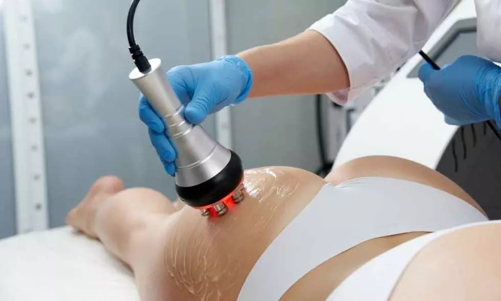 3, 6, 9, or 12 Cavitation, Radiofrequency, and Vacuum Package