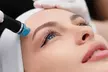 Ausreinigung, Peeling Anti-Aging, Microdermabrasion od. Microneedling PURE/KOLLAGEN für 1 Pers. (bis 62% sparen) - Second Medium