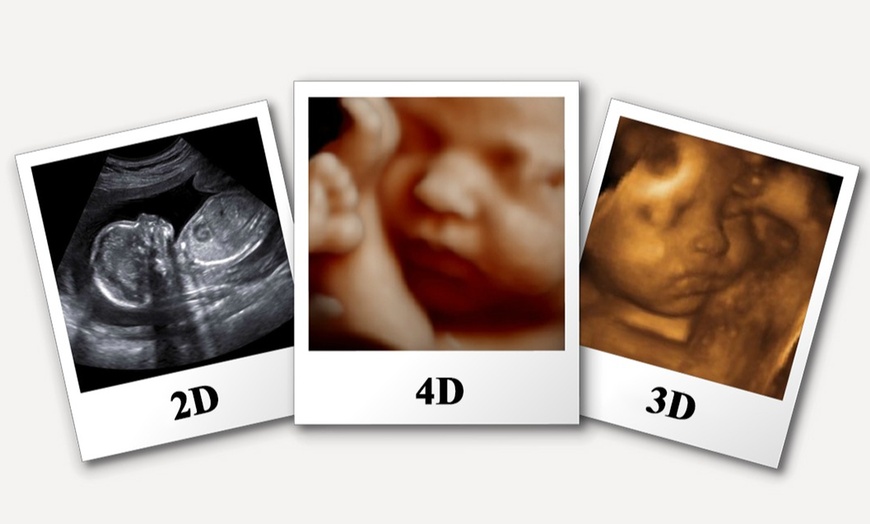 Image 1: Ultrasound Gender Scan