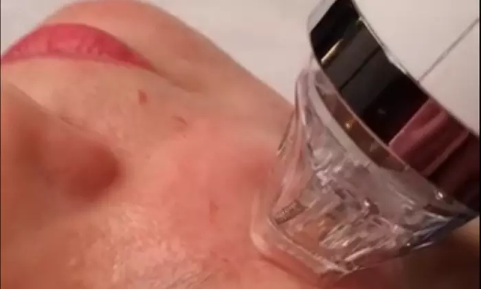 60-Minute 1, 3, or 5x Cold Plasma Facial (Acne or Anti-Aging)