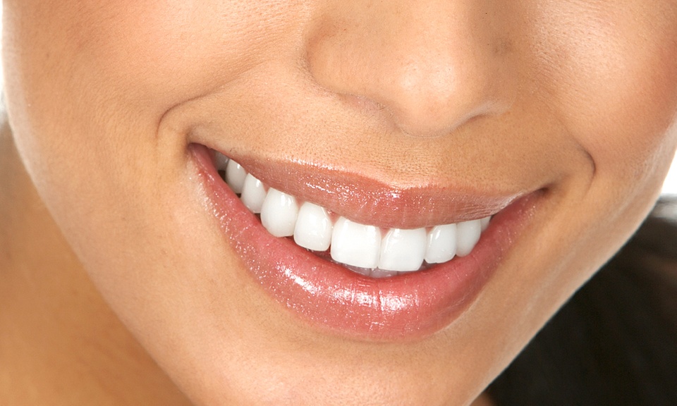 Śnieżnobiały uśmiech