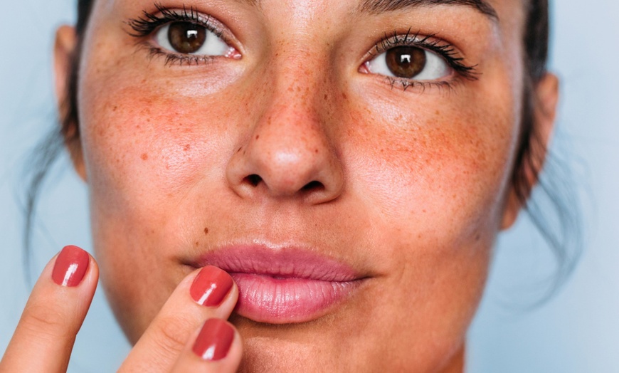 Image 3:  Unlimited Units for Full Face of Xeomin - Available on Sunday