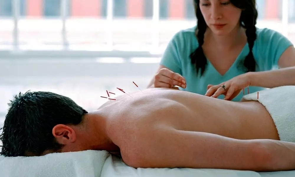 1 o 3 sesiones de acupuntura de 40 minutos