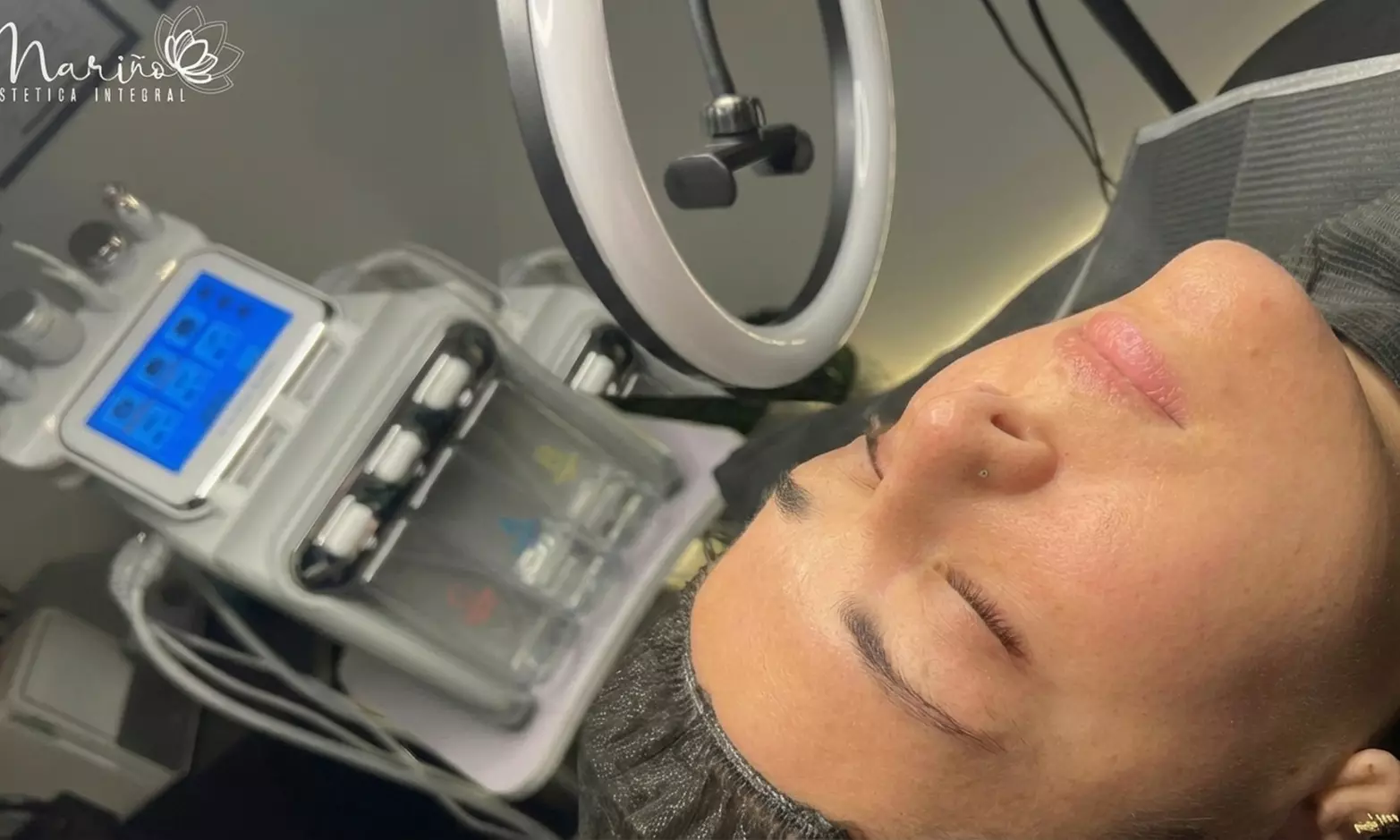 Hidrolimpieza facial con cóctel de vitaminas y/o tratamiento orbicular