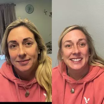 3D eyebrow microblading for beautifully defined brows