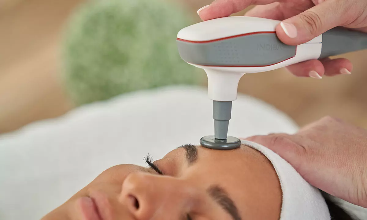 1 o 2 sesiones de tratamiento reafirmante y radiofrecuencia facial