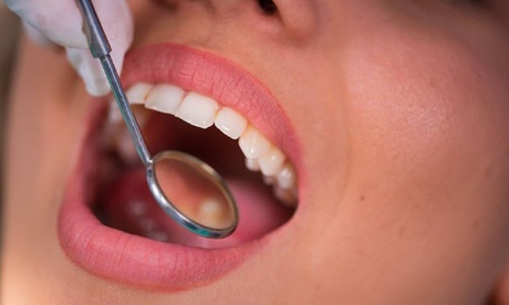 Visita con pulizia denti, otturazione e sbiancamento led (sconto fino a 86%)