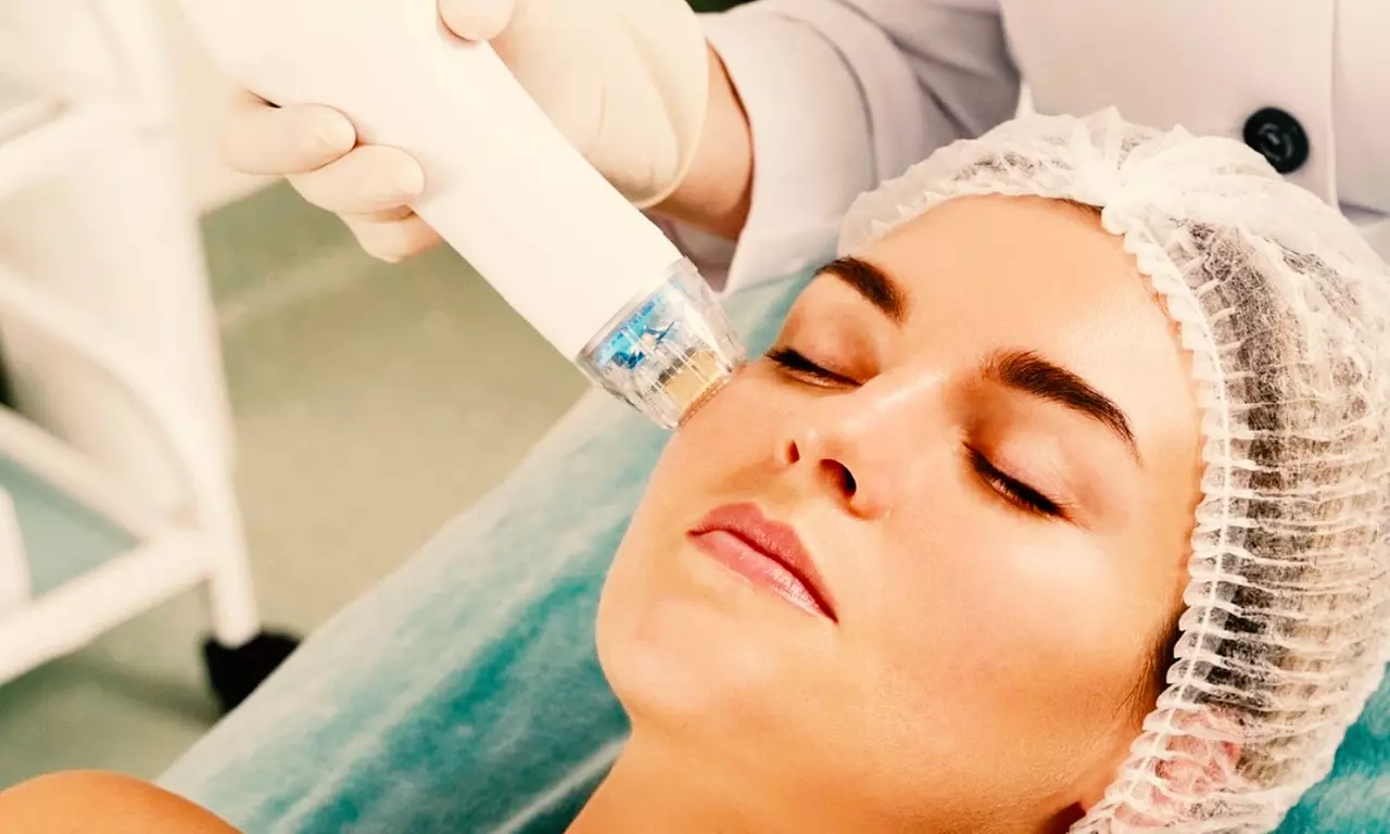 Tratamiento con exosomas y dermapen en 1 o 3 zonas a elegir, para una persona, en Centro de Estética Lorena Robles - Primary Image