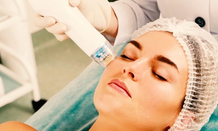 1 zona a elegir: Tratamiento con exosomas y dermapen - Centro de Estética Lorena Robles