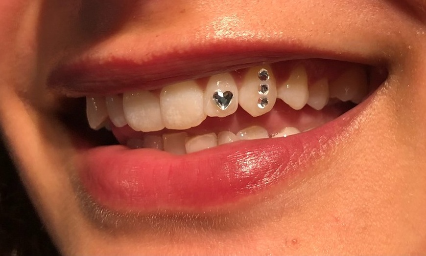 Image 2: Geef je glimlach een schitterende upgrade met 1 of 4 Swarovski tandkristallen bij (tot 43% korting)