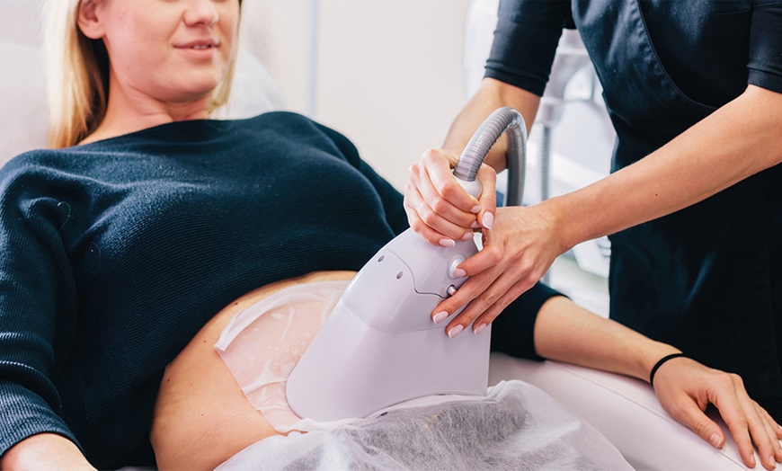 Image 2: Séances de cryolipolyse sur 1 zone au choix à Millenium Minceur Beauté