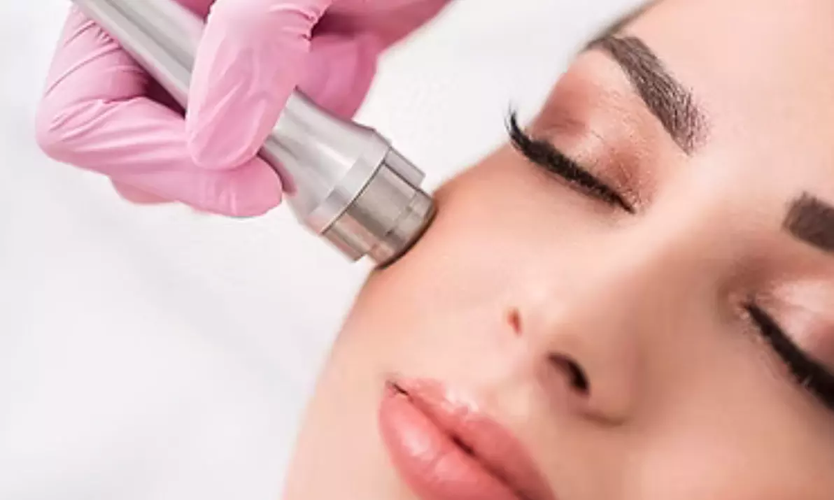 Get an Oxygen Facial or Diamond  with Microdermabrasion at Seven Corners Aesthetics -Up to 47% Off - Primary Image